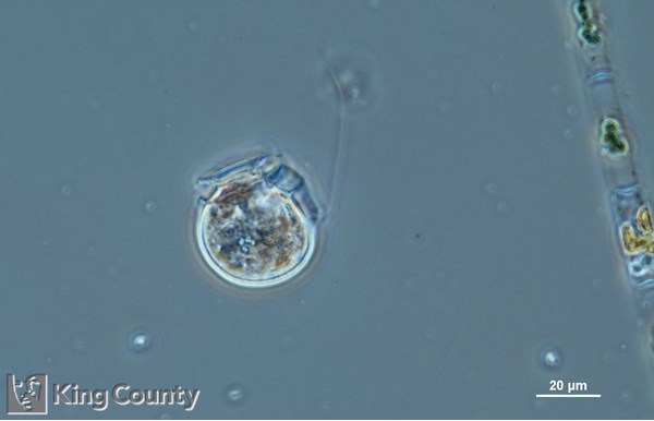 Photo of Dinophysis parva